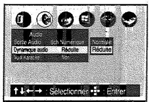 TOSHIBA SD 22 VE - Dynamique audio (contrôle de la gamme d'amplification) - 1