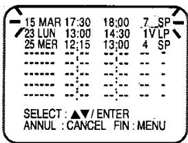 TOSHIBA SD 22 VE - Confirmation/Annulation de l'enregistrement automatique - 1