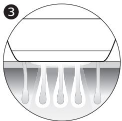 PHILIPS Bri945 - Principe de fonctionnement de la lumière pulsée intense - 3