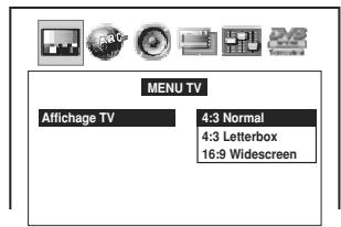 TOSHIBA SD P90 DT NOIR - Explications des réglages - 2
