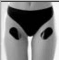 SLENDERTONE SHORT FLEX - Remarque: retrait des piles - 4