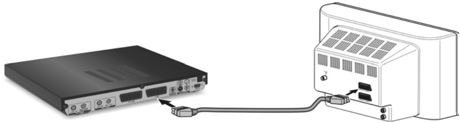 SIEMENS GIGASET M 475 T - Raccordement du téléviseur - 1
