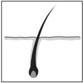 REMINGTON IPL 4000 - Que fait i-Light? - 1