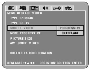 DENON DVD-A11 - REMARQUE: - 1