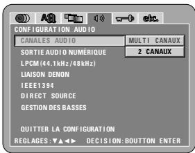 DENON DVD-A11 - 3 - 1