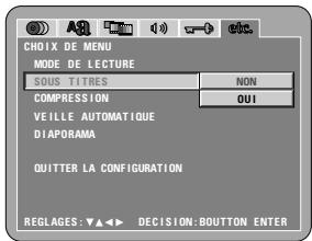 DENON DVD-A11 - MODEVIDEO - 2