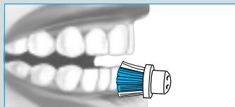 BRAUN OC 17 OXYJET - Enlvement de la plaque - 4