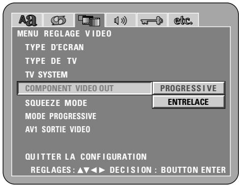 DENON DVD-A1XV - REMARQUE: - 5