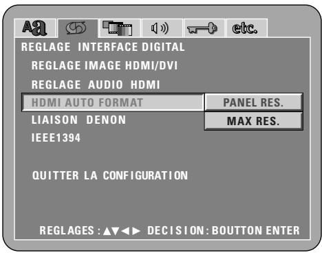 DENON DVD-A1XV - 2nd (ANALOG) - 4