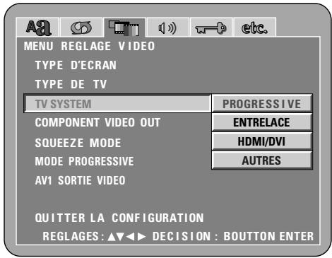 DENON DVD-A1XV - REMARQUE: - 4
