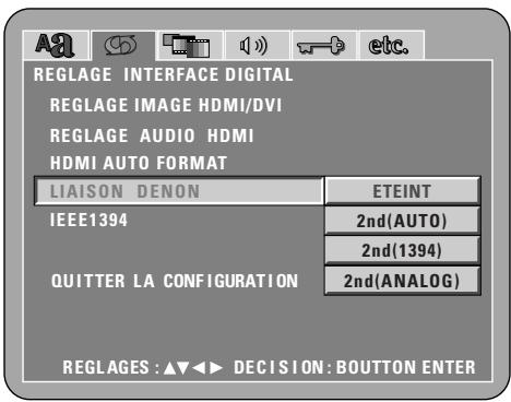 DENON DVD-A1XV - 2nd (ANALOG) - 5