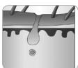 BEURER EpilateurIPL 5800 - 57500 kK gh - Fonctionnement de la technologie IPL - 3