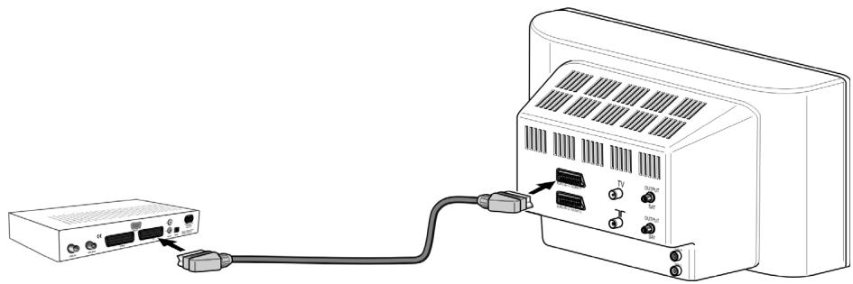 SIEMENS M340 T - Raccordement du téléviseur - 1