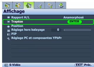 BENO W2000 - Correction de la distorsion de l'image - 2