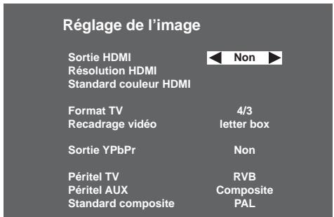SAGEM DTR 94160S - 6-2-2 Sorties en utilisation SD - 1