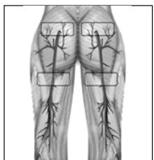 SLENDERTONE SHORT BOTTOM FEMME - 2