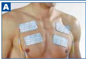 SPORT ELEC MULTISPORTPRO - POSITIONNER LES ÉLECTRODES - 1