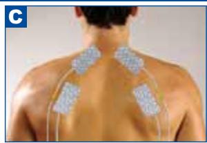 SPORT ELEC MULTISPORTPRO - POSITIONNER LES ÉLECTRODES - 3