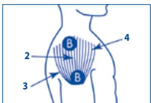 SPORT ELEC MULTISPORTPRO - POSITIONNER LES ÉLECTRODES - 5