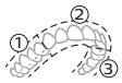 PHILIPS HX7108/01 - BrushPacer - 1