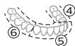 PHILIPS HX7108/01 - BrushPacer - 2