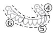 PHILIPS HX7108/01 - "BrushPacer" - 2