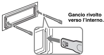 SONY CDXGT440E - Rimuovere l'apparecchio. - 1