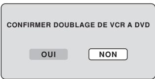 SHARP DV-RW250F - REMARQUE: - 1