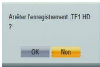 CGV 70125 - Arrêteur enregistrement - 1