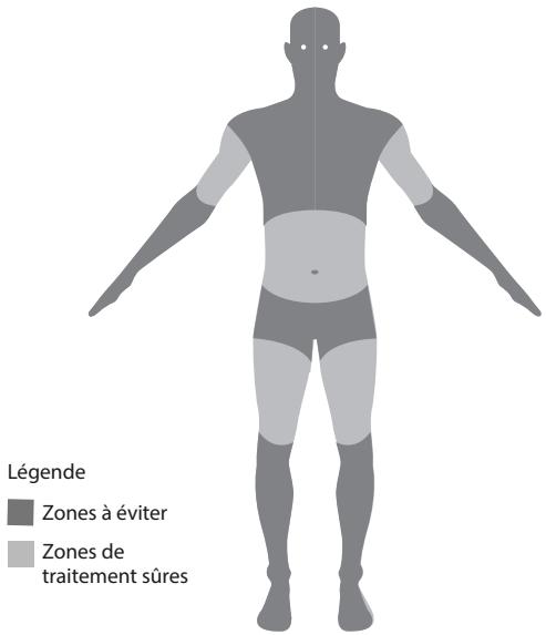 HOMEDICS ULTRASLIM USL1000 EU - Zones de traitement et endroits à éviter - 1