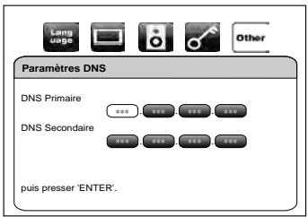 MARANTZ BD5004/N1SG - Paramètres DNS - 1