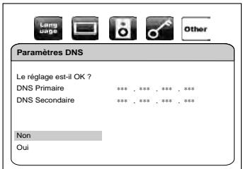 MARANTZ BD5004/N1SG - Paramètres DNS - 2