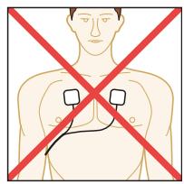 REVITIVE REViTIVE MEDIC PLUS - ÉTAPE 5 : UTILISATION DES ÉLECTRODES CORPORELLES - 4
