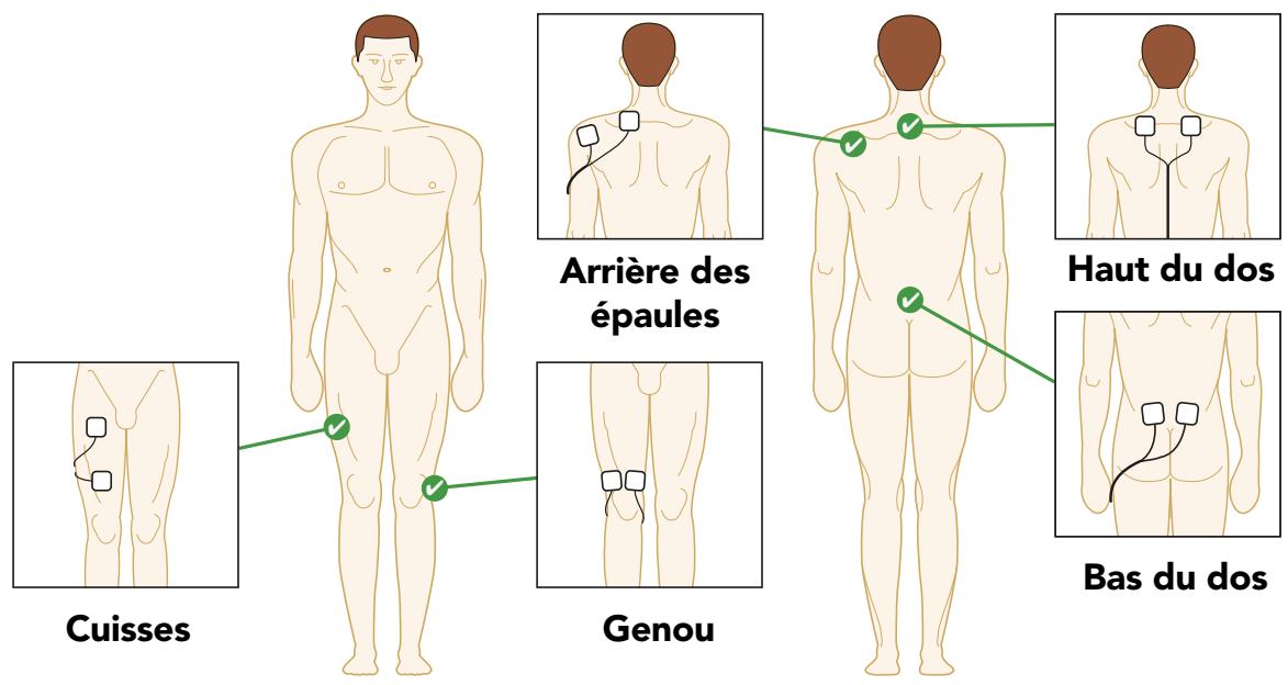 REVITIVE REViTIVE MEDIC PLUS - ÉTAPE 5 : UTILISATION DES ÉLECTRODES CORPORELLES - 1