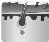 BEURER iPL 8500 VELVET - Quelle influence le cycle de croissance des poils a-t-il sur l'epilation à la lumière ? - 2