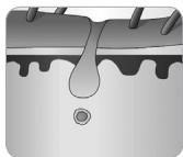 BEURER iPL 8500 VELVET - Quelle influence le cycle de croissance des poils a-t-il sur l'epilation à la lumière ? - 3