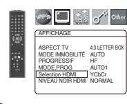 DENON DVD-1920 - (Defaut : NORMAL) - 1