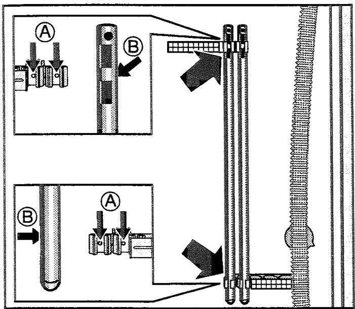 MIELE W2260 - Démontage des sécurités de transport - 7