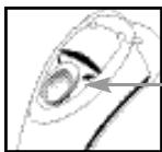 REMINGTON R9200 - Irritation : - 1