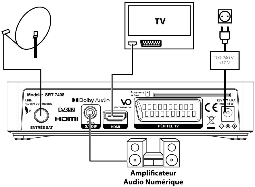 STRONG SRT 7408 - Branchement à l'amplificateur audio numérique - 1