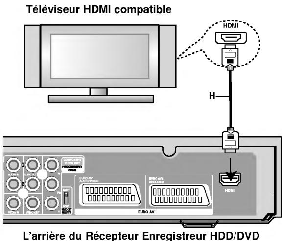 LG LH-RH7000S - Attention: - 1