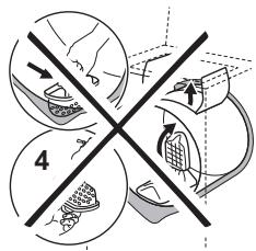 Medical illustration showing surgical procedure with labeled steps and cross-sectional views
