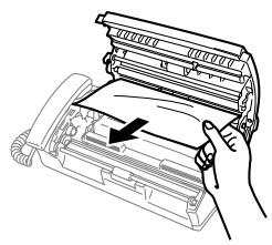 BROTHER FAX-T102,  FAX-T104,  FAX-T106 - Bourrage de papier - 3