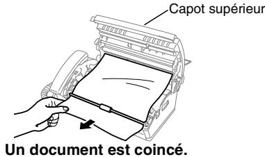 BROTHER T104 - Bourrage de documents - 2