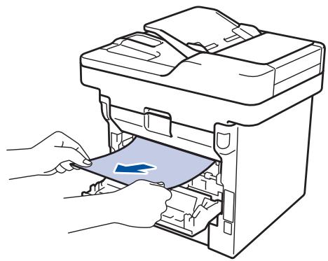 BROTHER DCP-L5500DN - Surface brulante - 2