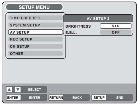 TOSHIBA D-VR5 - Préparation: - 1