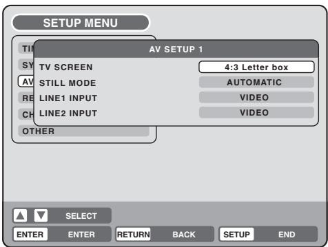 TOSHIBA D-VR5 - Préparation: - 1