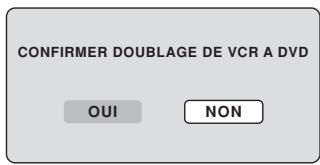 SHARP DV-RW250F - REMARQUE: - 1