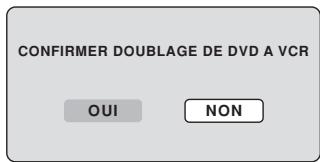 SHARP DV-RW250F - REMARQUE : - 1
