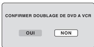 SHARP DV-RW270F - Remarque : - 1
